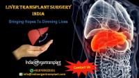 Best hospital for liver transplant in india image 1